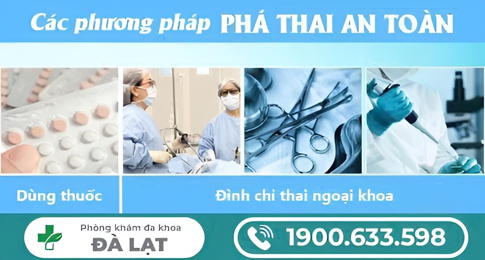 Hình ảnh minh họa